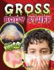 Gross_body_stuff